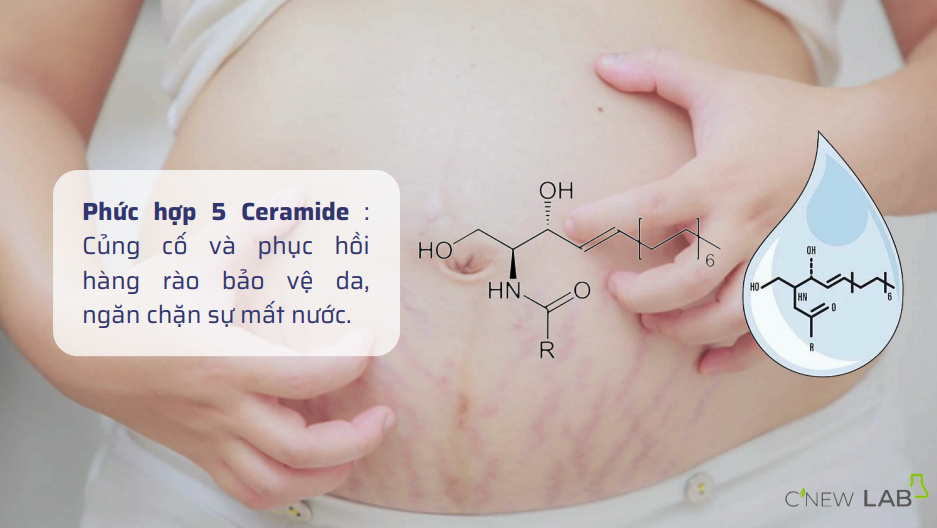 C’New Lab New CK - Sáp rạn da dạng Balm dành cho bà bầu